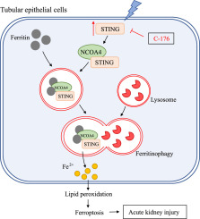 STING promotes ferroptosis through NCOA4-dependent ferritinophagy in acute kidney injury