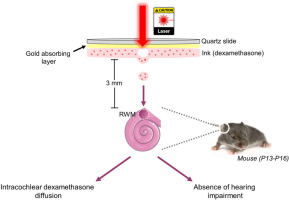 Proof of Concept of Intracochlear Drug Administration by Laser-Assisted Bioprinting in Mice