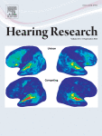 Optimising a computational model of human auditory cortex with an evolutionary algorithm