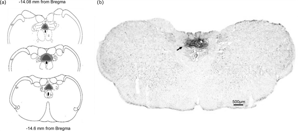 Acute inhibition of nicotinamide adenine dinucleotide phosphate oxidase in the commissural nucleus of the solitary tract reduces arterial pressure and renal sympathetic nerve activity in renovascular hypertension