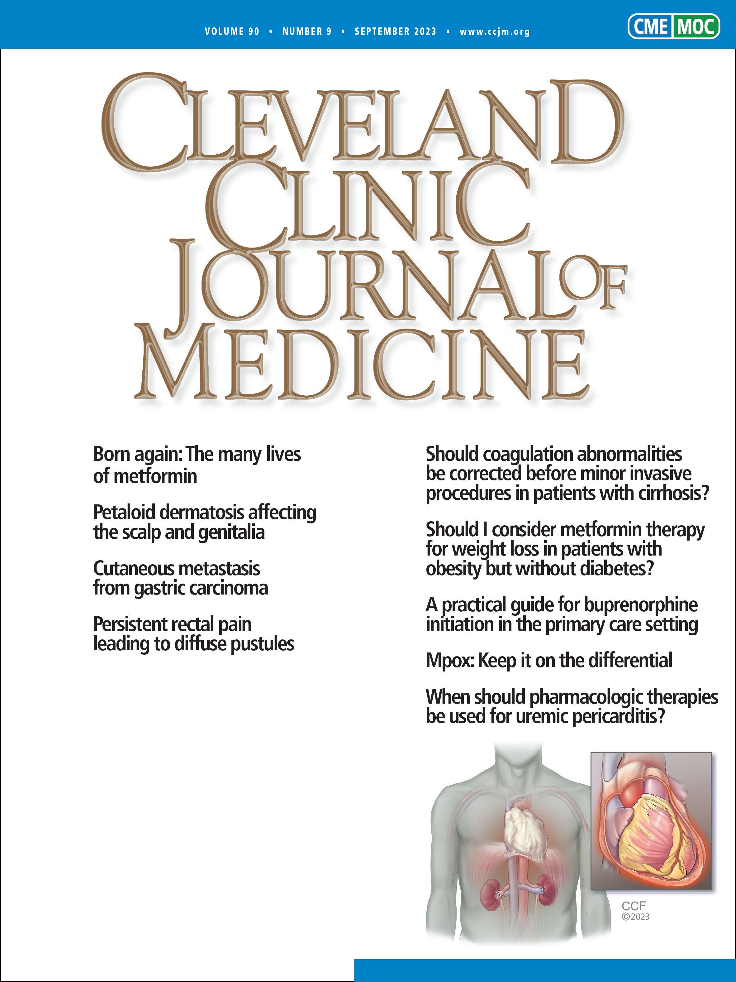Persistent rectal pain leading to diffuse pustules