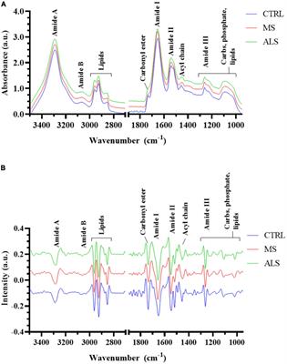 Biomolecular alterations detected in multiple sclerosis skin fibroblasts using Fourier transform infrared spectroscopy