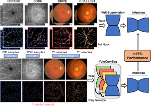 YoloCurvSeg: You only label one noisy skeleton for vessel-style curvilinear structure segmentation