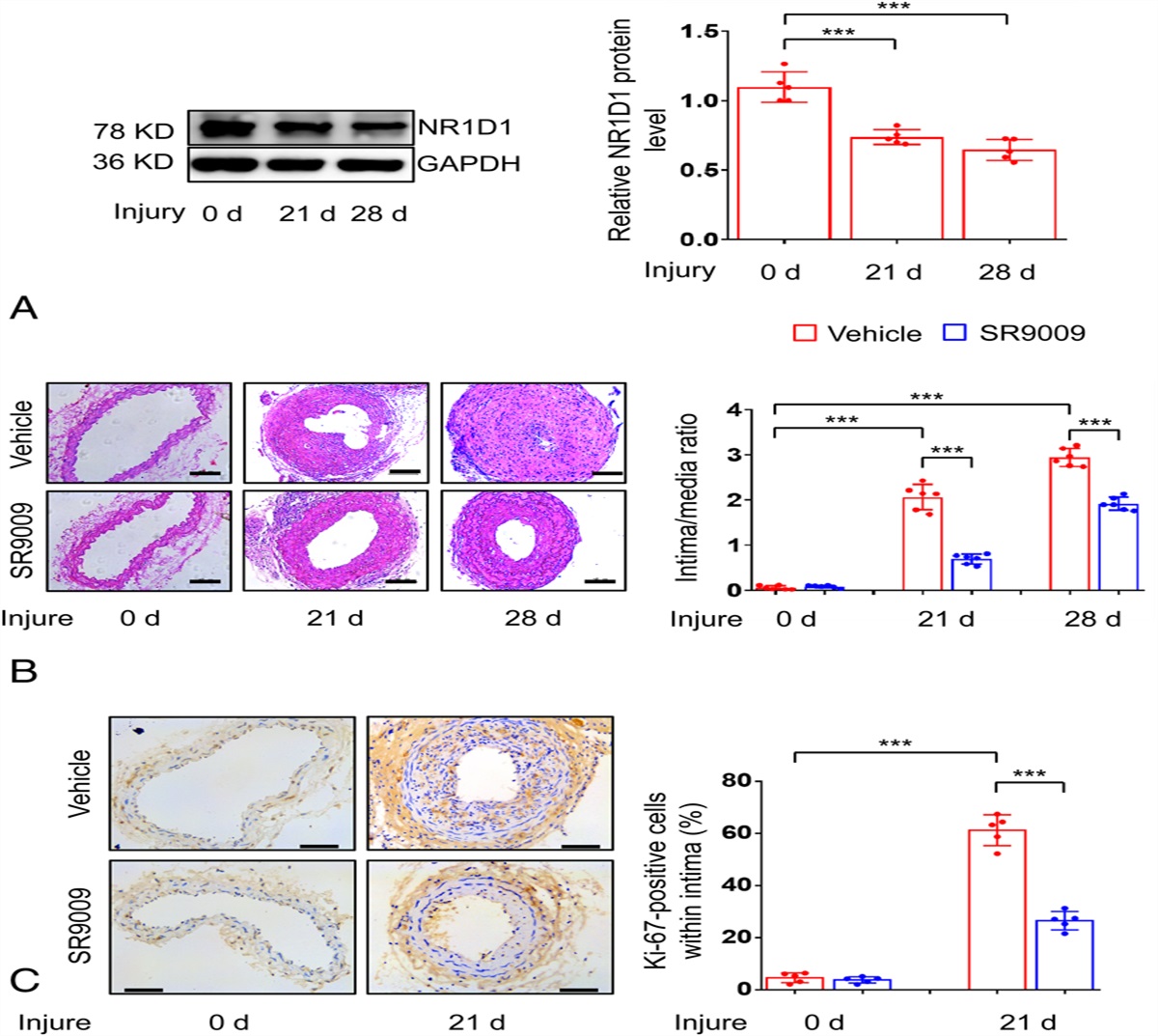 Role of Nuclear Receptor Subfamily 1 Group D Member 1 in the Proliferation, Migration of Vascular Smooth Muscle Cell, and Vascular Intimal Hyperplasia