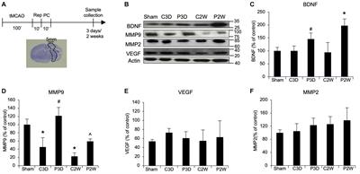 Postconditioning promotes recovery in the neurovascular unit after stroke