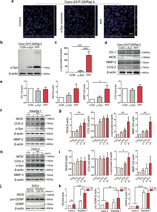 Addition of α-synuclein aggregates to the intestinal environment recapitulates Parkinsonian symptoms in model systems