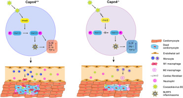 Macrophage CAPN4 regulates CVB3-induced cardiac inflammation and injury by promoting NLRP3 inflammasome activation and phenotypic transformation to the inflammatory subtype