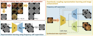 A generic fundus image enhancement network boosted by frequency self-supervised representation learning