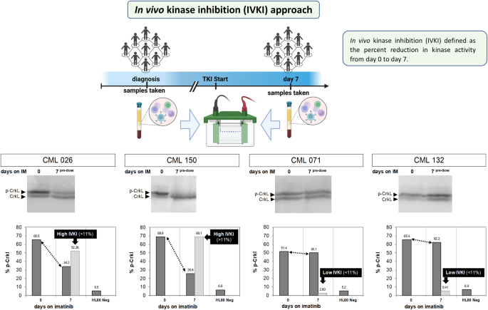 Adverse outcomes for chronic myeloid leukemia patients with splenomegaly and low in vivo kinase inhibition on imatinib