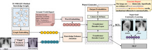 MKCL: Medical Knowledge with Contrastive Learning model for radiology report generation