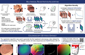 Colonoscopy 3D video dataset with paired depth from 2D-3D registration