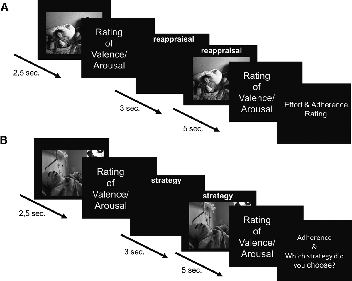 Emotional Reactivity, Emotion Regulation, and Regulatory Choice in Somatic Symptom Disorder