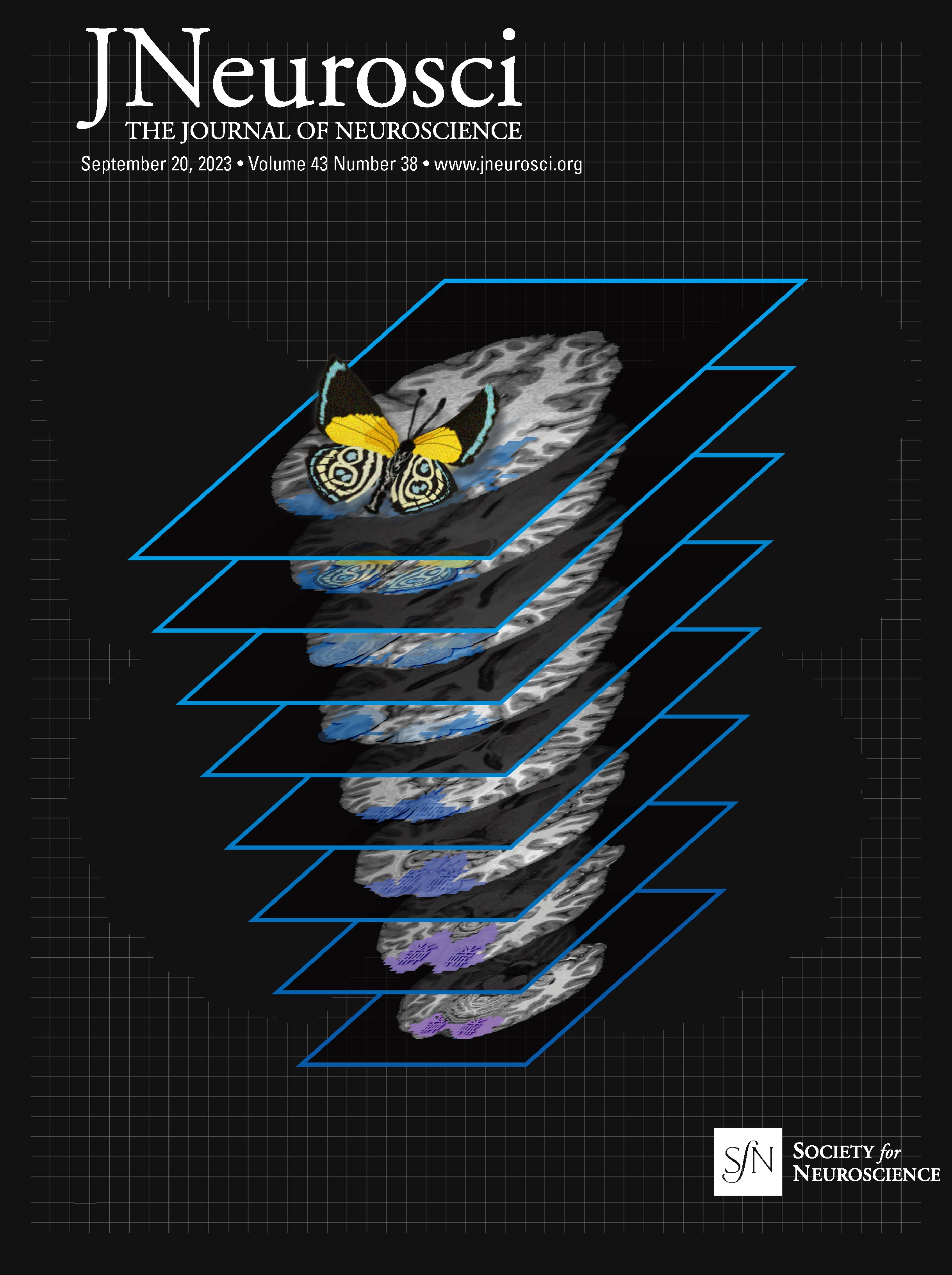 Distinct Lateral Prefrontal Regions Are Organized in an Anterior-Posterior Functional Gradient