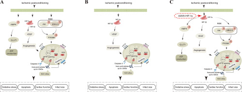 The mechanism and targeted intervention of the HIF-1 pathway in improving atherosclerotic heart's sensitivity to ischemic postconditioning