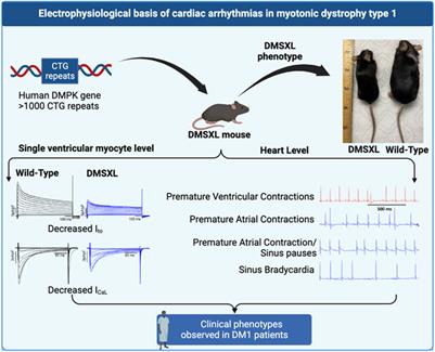 Electrophysiological basis of cardiac arrhythmia in a mouse model of myotonic dystrophy type 1