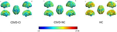 Dynamic alterations in the amplitude of low-frequency fluctuation in patients with cerebral small vessel disease
