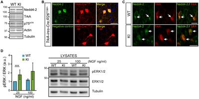 Enhanced TrkA signaling impairs basal forebrain-dependent behavior