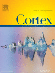 The timing of confidence computations in human prefrontal cortex