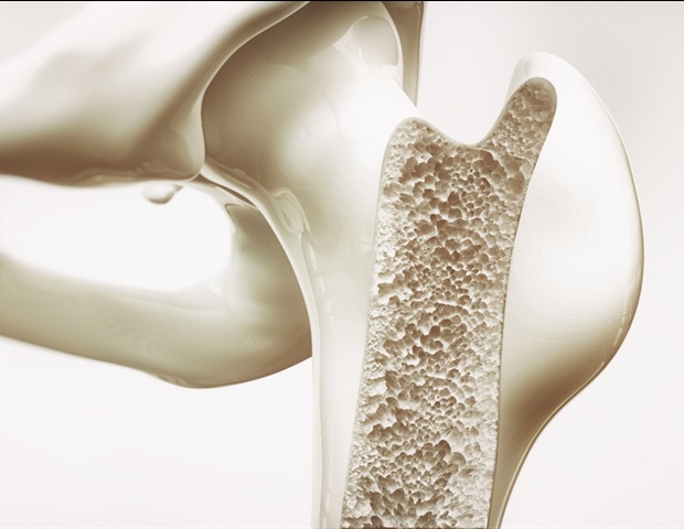 Certain gut microbes may be linked to skeletal health