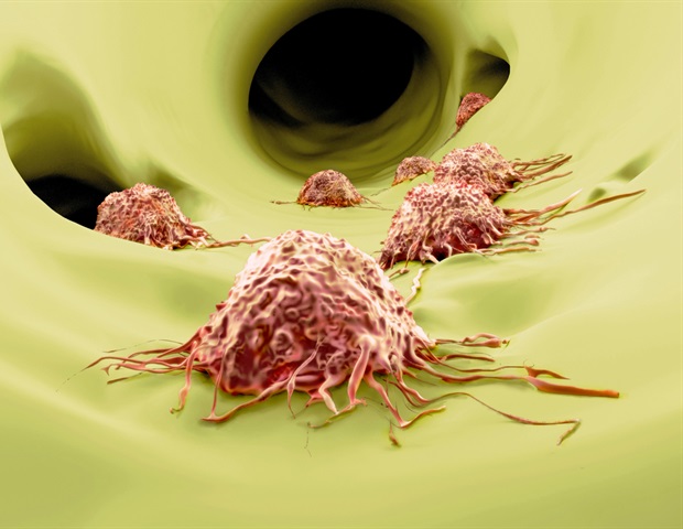 Mechanoresilient cancer cells more prone to metastasis