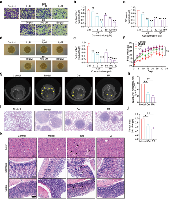 Rosmarinic acid in combination with ginsenoside Rg1 suppresses colon cancer metastasis via co-inhition of COX-2 and PD1/PD-L1 signaling axis