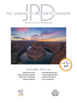 Three-dimensional guided lateral window sinus lift and simultaneous implant placement: A dental technique