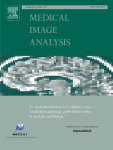 Active learning for medical image segmentation with stochastic batches