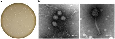 StAP1 phage: an effective tool for treating methicillin-resistant Staphylococcus aureus infections