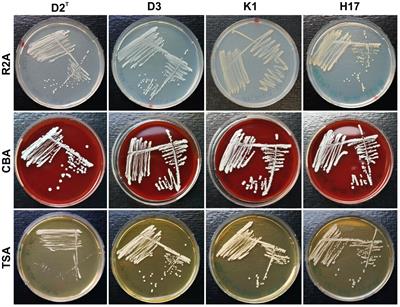 Identification of staphyloxanthin and derivates in yellow-pigmented Staphylococcus capitis subsp. capitis