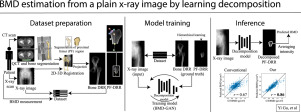 Bone mineral density estimation from a plain X-ray image by learning decomposition into projections of bone-segmented computed tomography