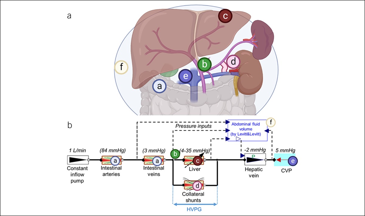 Portal Venous Remodeling Determines the Pattern of Cirrhosis Decompensation: A Systems Analysis