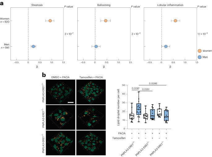 A gene-by-sex interaction contributes to liver disease susceptibility in women