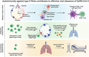 Autoreactive T cells targeting type II pneumocyte antigens in COVID-19 convalescent patients
