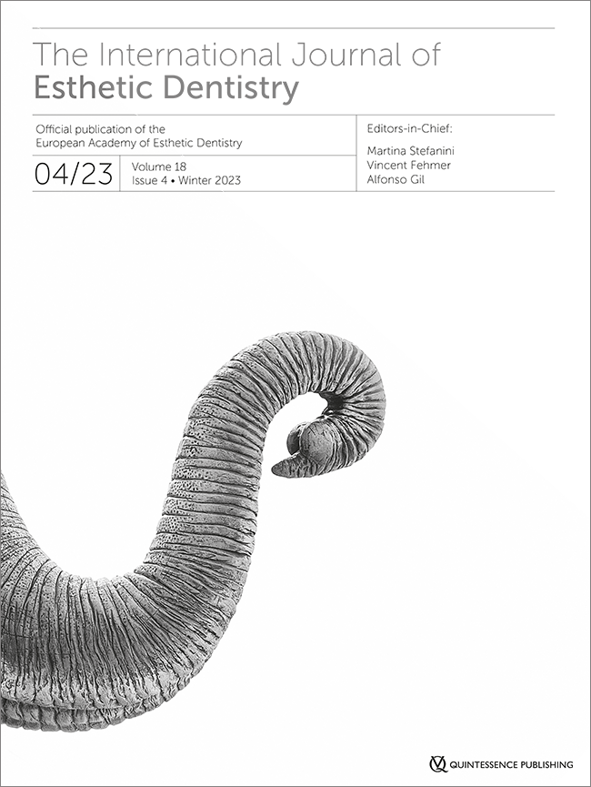 Esthetic rehabilitation through crown lengthening and laminate veneers