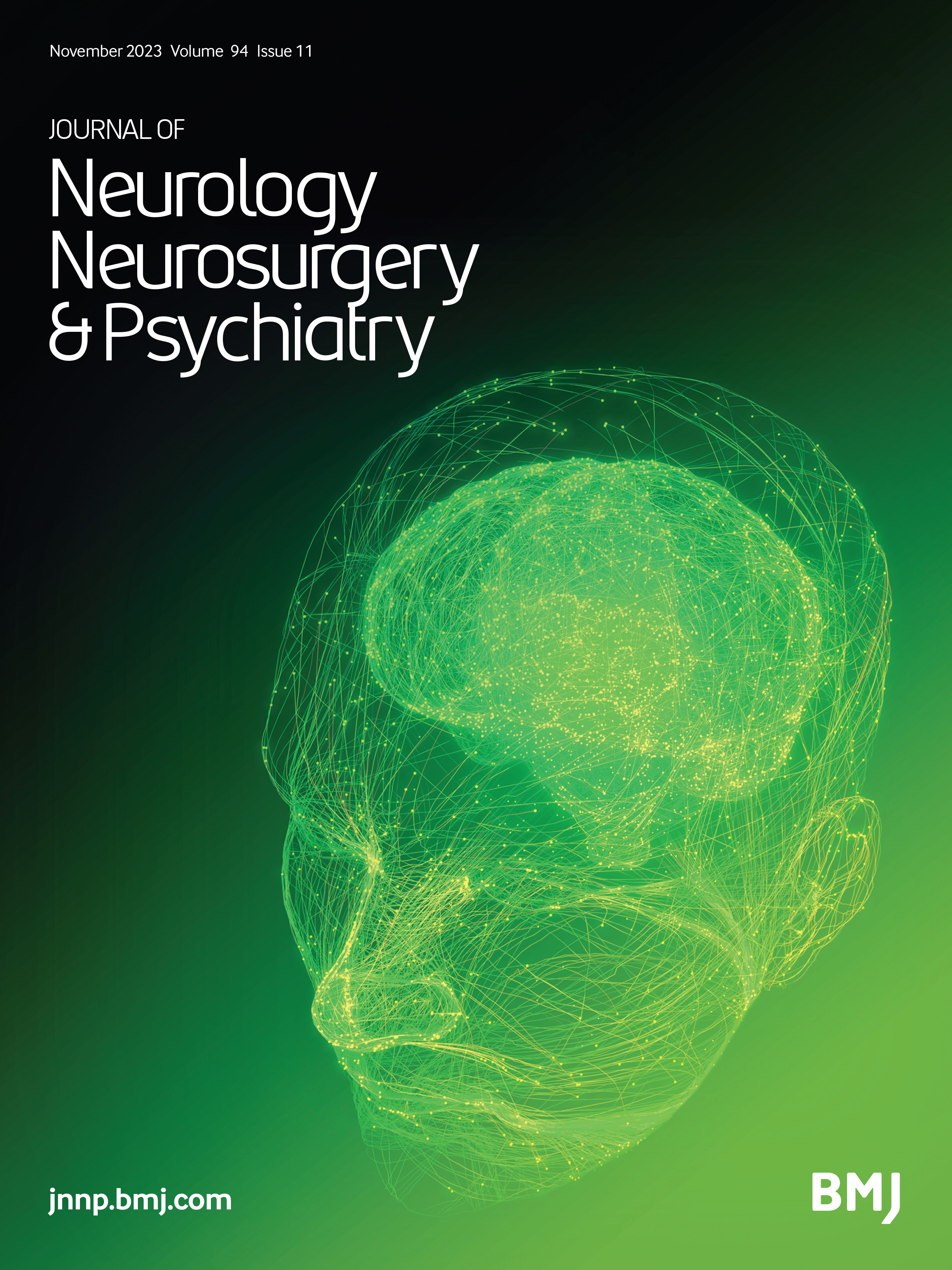 Gait-combined closed-loop brain stimulation can improve walking dynamics in Parkinsonian gait disturbances: a randomised-control trial