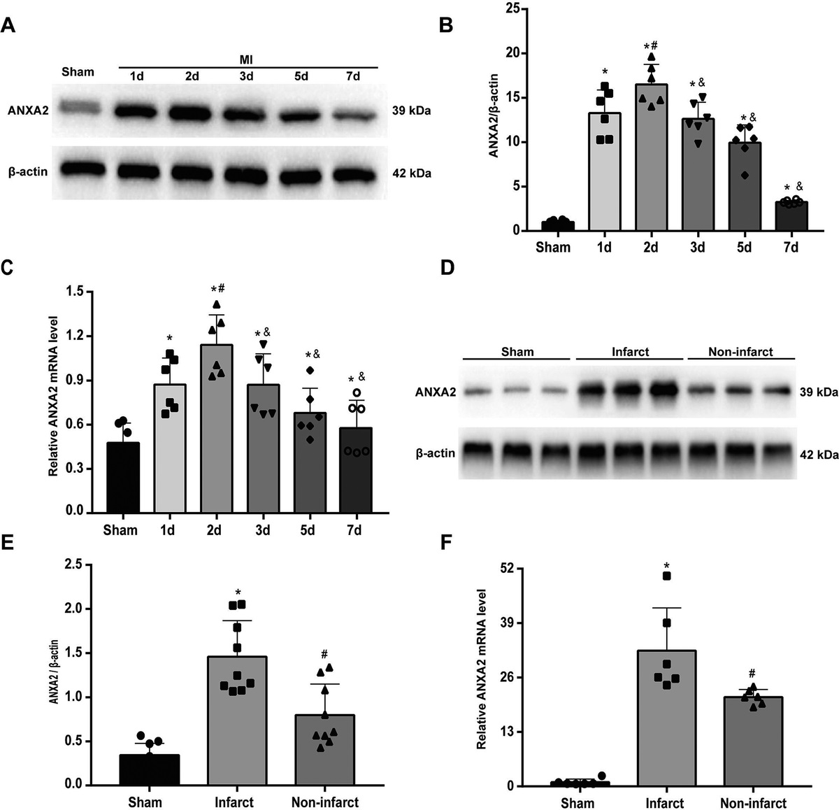 ANNEXIN A2 FACILITATES NEOVASCULARIZATION TO PROTECT AGAINST MYOCARDIAL INFARCTION INJURY VIA INTERACTING WITH MACROPHAGE YAP AND ENDOTHELIAL INTEGRIN Β3
