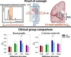 The dependence of cerebral interstitial fluid on diffusion-sensitizing directions: A multi-b-value diffusion MRI study in a memory clinic sample