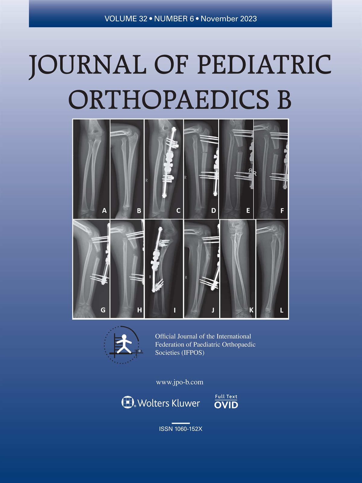 Letter to the Editor regarding Liu et al.: ‘Ulnar osteotomy and monolateral external fixator for the treatment of chronic Monteggia fractures in children: comparison between gradual and acute radial head reduction’