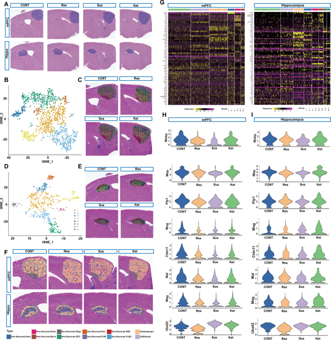 Myelin-associated oligodendrocytic basic protein-dependent myelin repair confers the long-lasting antidepressant effect of ketamine