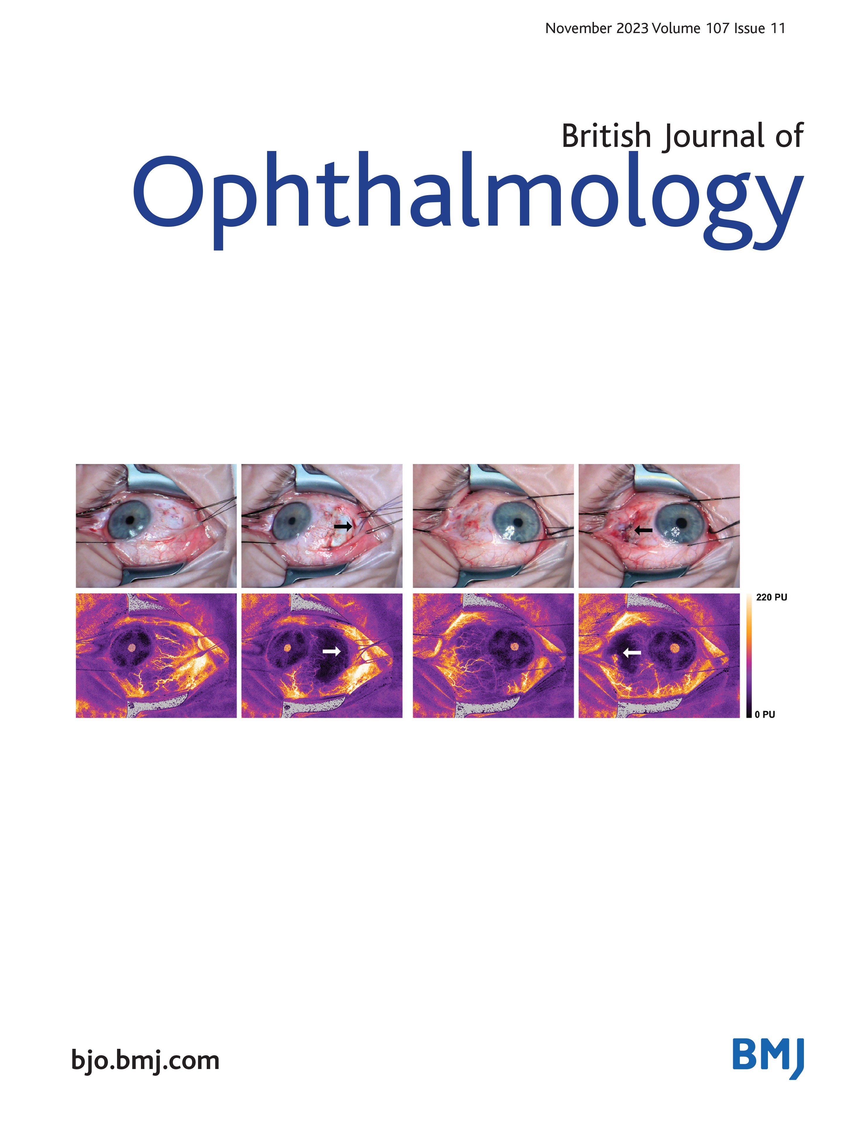 Association of macular OCT and OCTA parameters with visual acuity in glaucoma