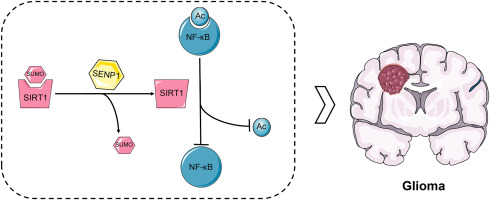 SENP1-mediated SUMOylation of SIRT1 affects glioma development through the NF-κB pathway