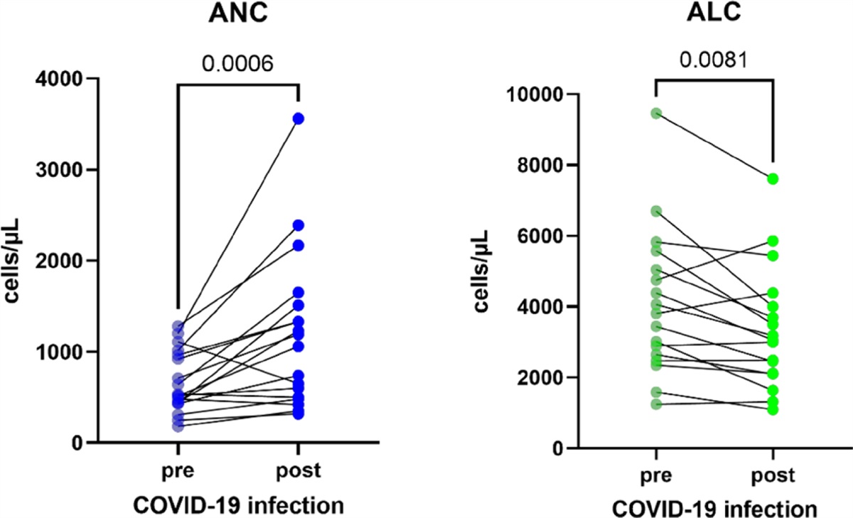 The Clinical Course of SARS-CoV-2 Infection in Patients With Autoimmune Neutropenia: A Retrospective Case Series Study