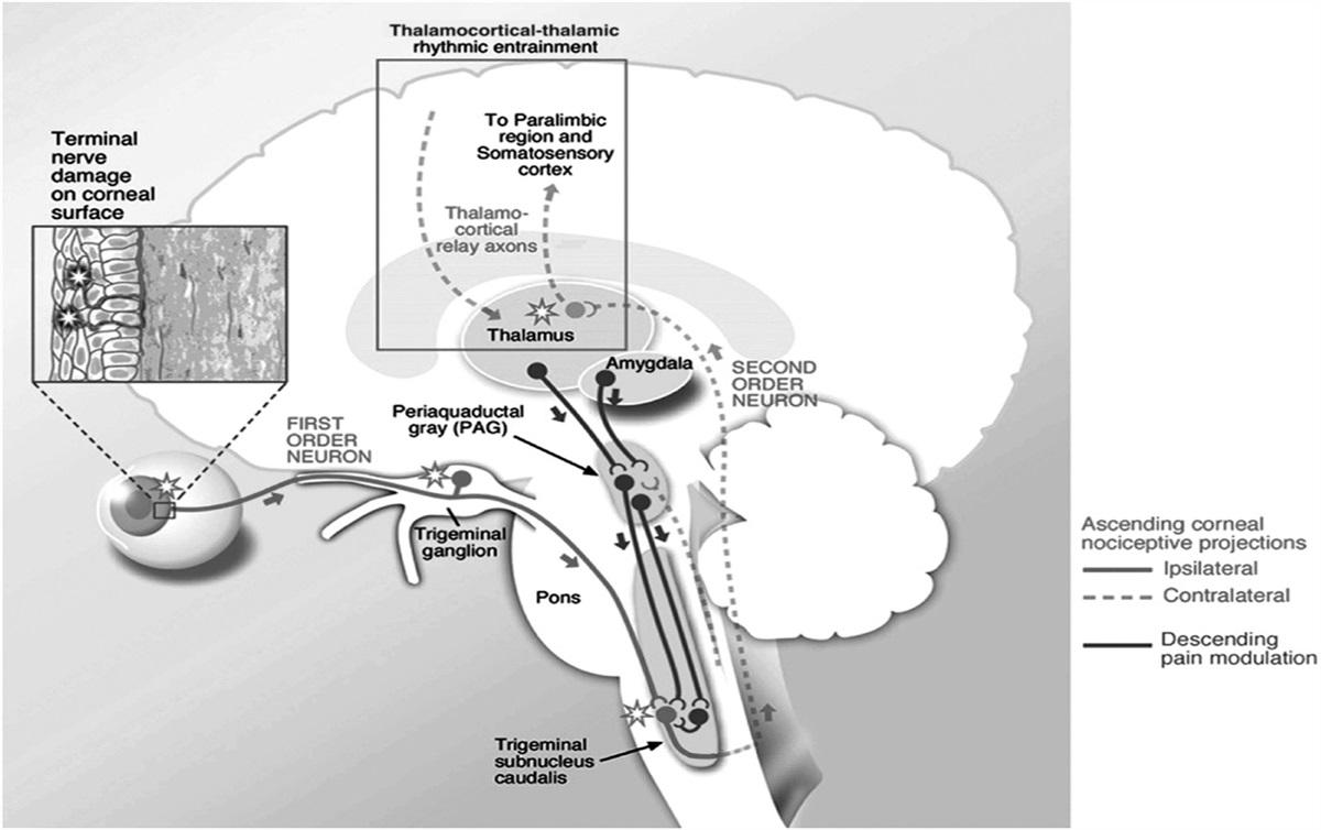Topical analgesics for acute corneal pain: current options and emerging therapeutics