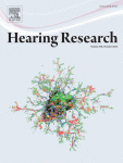 Behavioral characterization of the cochlear amplifier lesion due to loss of function of stereocilin (STRC) in human subjects.