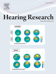 From the outer ear to the nerve: A complete computer model of the peripheral auditory system
