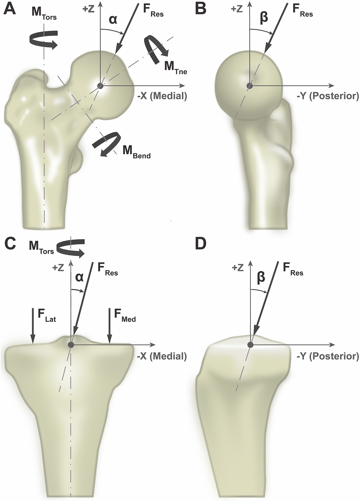 Loading of the Hip and Knee During Swimming: An in Vivo Load Study
