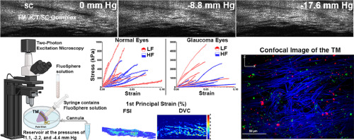Segmental biomechanics of the normal and glaucomatous human aqueous outflow pathway