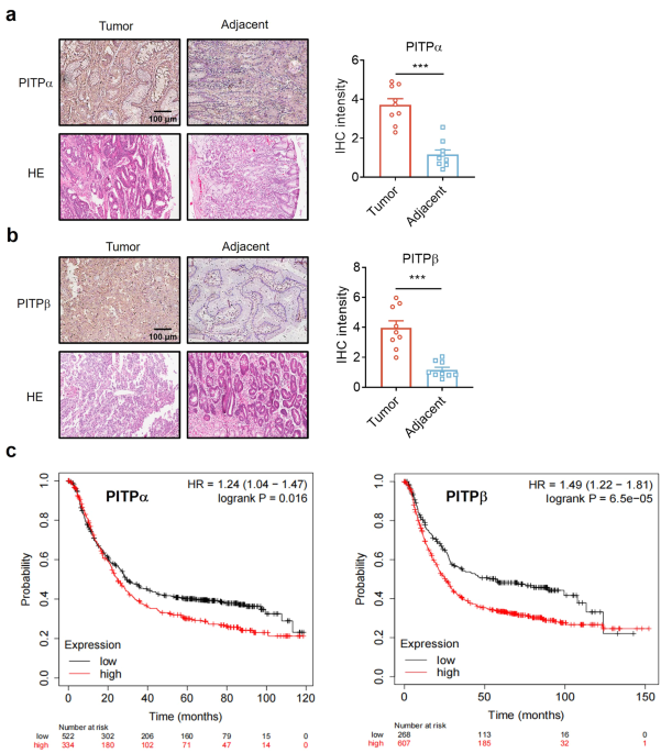 Microcolin H, a novel autophagy inducer, exerts potent antitumour activity by targeting PITPα/β