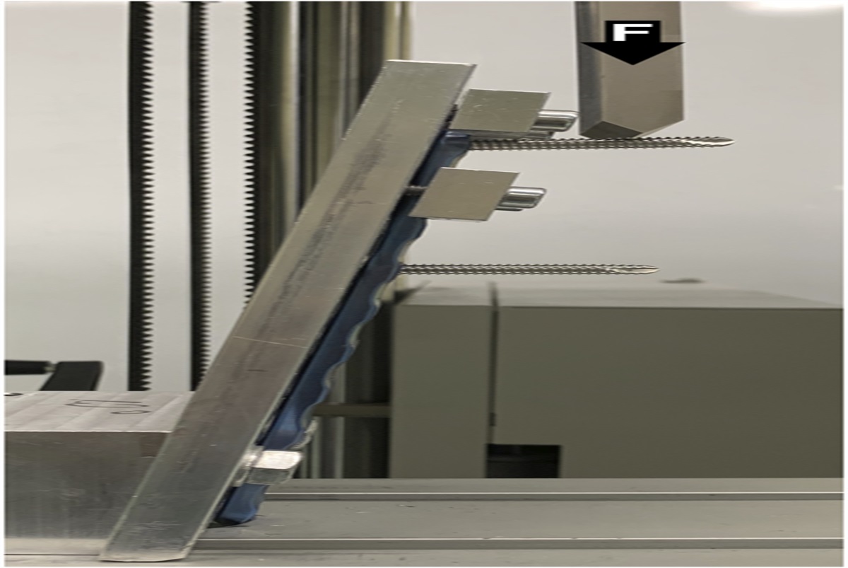 Biomechanical Evaluation of Variable-Angle Locking Systems. A Micro-CT Analysis