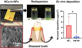 Curcumin nanocrystals-in-nanofibres as a promising platform for the management of periodontal disease